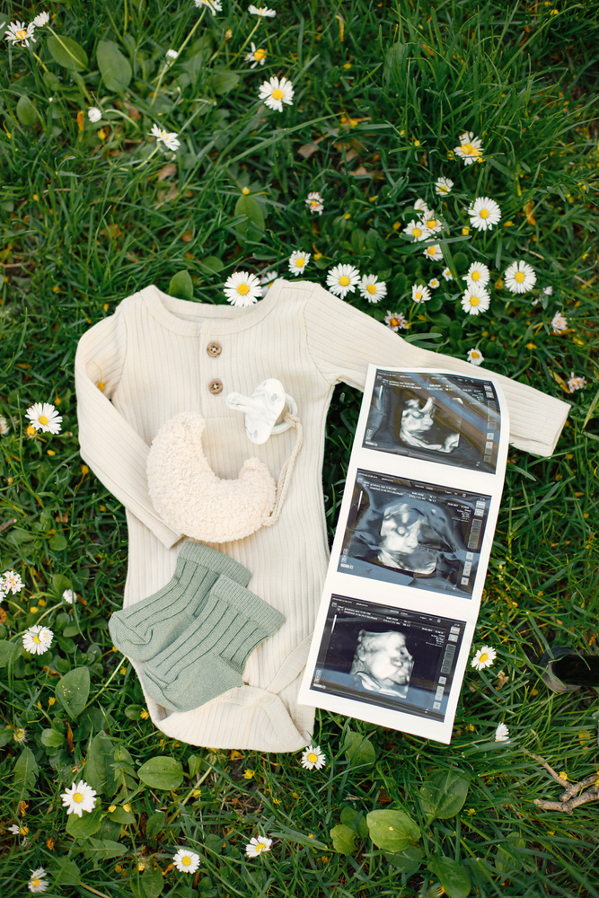 Baby Clothes and Ultrasound Photo on Grass